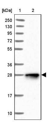 Western Blot: NUDT8 Antibody [NBP1-81908]