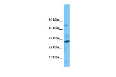 Western Blot: NUDT8 Antibody [NBP2-87964]