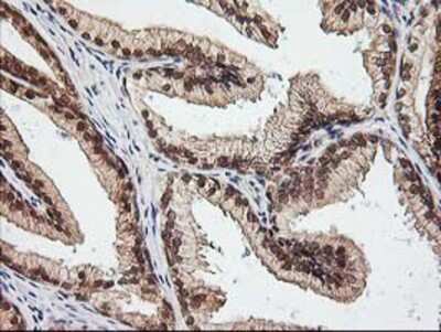 Immunohistochemistry-Paraffin: NUDT9 Antibody (OTI7A12) [NBP2-01072]