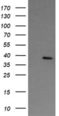 Western Blot: NUDT9 Antibody (OTI 7F12) [NBP2-46277]