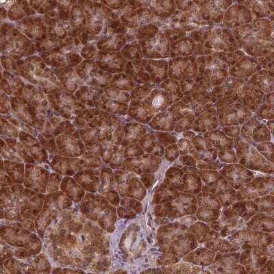 Immunohistochemistry: NUDT9 Antibody [NBP2-48818]