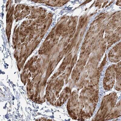 Immunohistochemistry-Paraffin: NUDT9 Antibody [NBP1-82715]