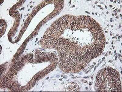 Immunohistochemistry: NUDT9 Antibody (OTI7A12) - Azide and BSA Free [NBP2-73126]