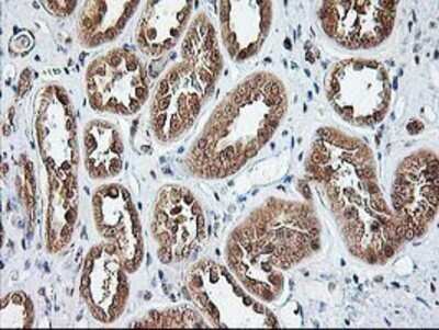 Immunohistochemistry: NUDT9 Antibody (OTI7A12) - Azide and BSA Free [NBP2-73126]
