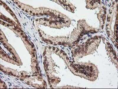 Immunohistochemistry: NUDT9 Antibody (OTI7A12) - Azide and BSA Free [NBP2-73126]