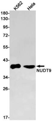 Western Blot: NUDT9 Antibody (S07-9C3) [NBP3-19723]