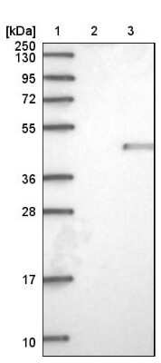 Western Blot: NUDT9 Antibody [NBP1-82715]