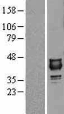 Western Blot: NUDT9 Overexpression Lysate [NBL1-13867]