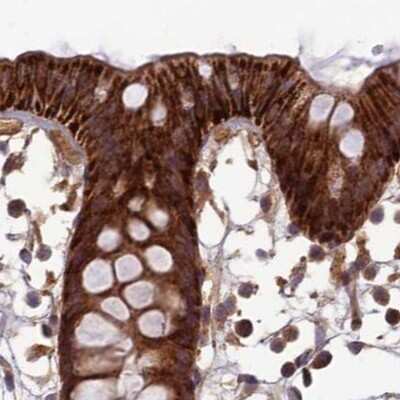 Immunohistochemistry-Paraffin: NULP1 Antibody [NBP1-92210]