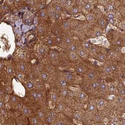 Immunohistochemistry-Paraffin: NULP1 Antibody [NBP1-92210]