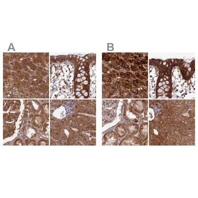Immunohistochemistry-Paraffin: NULP1 Antibody [NBP1-92211]