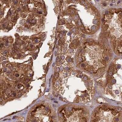 Immunohistochemistry-Paraffin: NULP1 Antibody [NBP1-92211]
