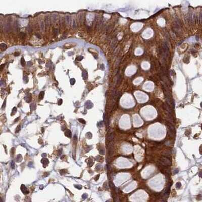 Immunohistochemistry-Paraffin: NULP1 Antibody [NBP1-92211]