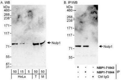 Western Blot: NULP1 Antibody [NBP1-71843]