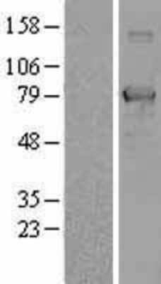 Western Blot: NULP1 Overexpression Lysate [NBL1-16773]