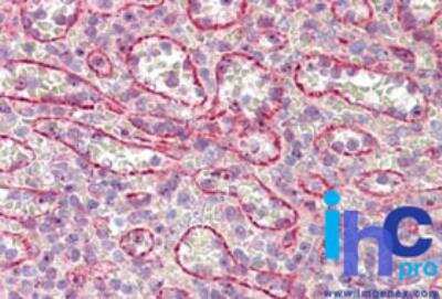 Immunohistochemistry-Paraffin: Numb Antibody [NBP2-27181]