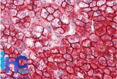 Immunohistochemistry-Paraffin: Numb Antibody [NBP2-27181]