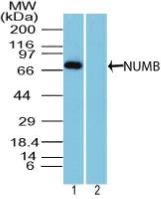 Western Blot: Numb Antibody [NBP2-27181]