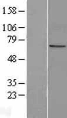 Western Blot: Numb Overexpression Lysate [NBL1-13870]