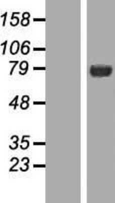 Western Blot: Numb Overexpression Lysate [NBP2-08847]