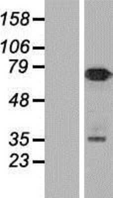 Western Blot: Numb Overexpression Lysate [NBP2-08848]