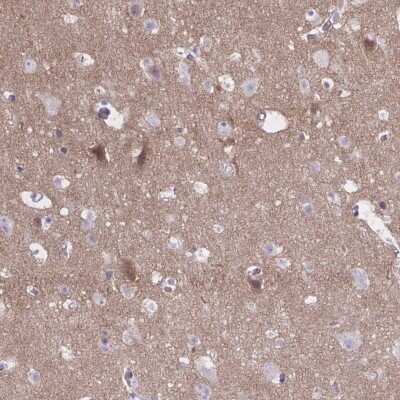 Immunohistochemistry-Paraffin: NUMBL Antibody [NBP2-34104]