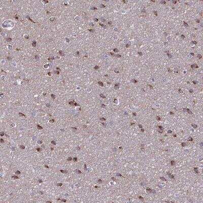 Immunohistochemistry-Paraffin: NUMBL Antibody [NBP2-34112]