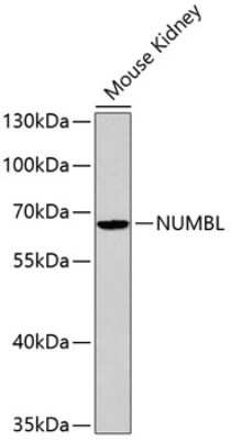 Western Blot: NUMBL AntibodyBSA Free [NBP3-04965]