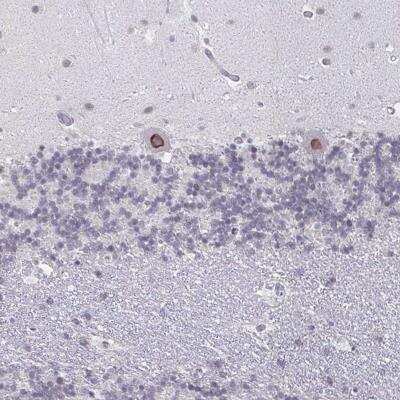 Immunohistochemistry-Paraffin: NUP133 Antibody [NBP2-31795]