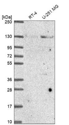 Western Blot: NUP133 Antibody [NBP2-31795]