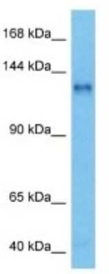 Western Blot: NUP133 Antibody [NBP3-10998]