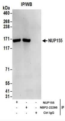Immunoprecipitation: NUP155 Antibody [NBP2-22286]