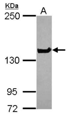 Western Blot: NUP155 Antibody [NBP2-19609]