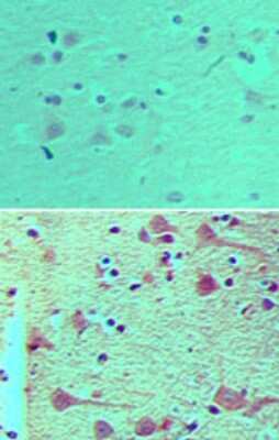 Immunohistochemistry-Paraffin: NUP160 Antibody [NBP2-23718]