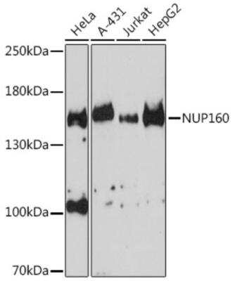 Western Blot: NUP160 AntibodyAzide and BSA Free [NBP2-93008]