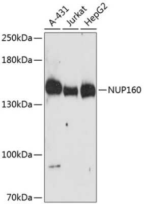 Western Blot: NUP160 AntibodyAzide and BSA Free [NBP2-94281]