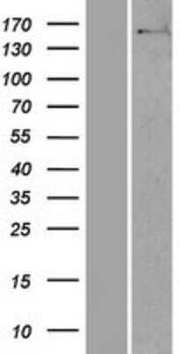 Western Blot: NUP160 Overexpression Lysate [NBP2-07199]