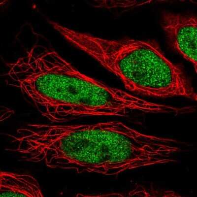 Immunocytochemistry/ Immunofluorescence: NUP188 Antibody [NBP2-38936]