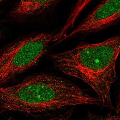 Immunocytochemistry/ Immunofluorescence: NUP188 Antibody [NBP2-56516]