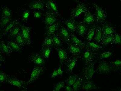 Immunocytochemistry/ Immunofluorescence: NUP188 Antibody [NBP3-06066]