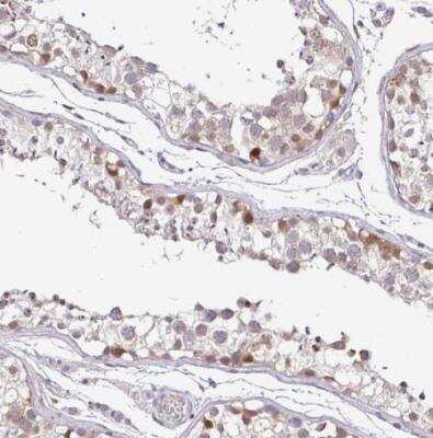 Immunohistochemistry-Paraffin: NUP188 Antibody [NBP2-38936]