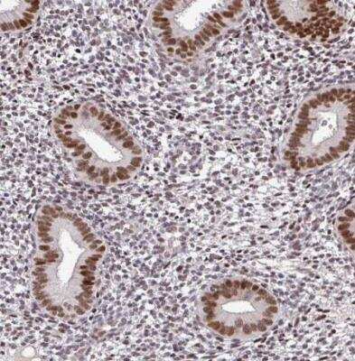 Immunohistochemistry-Paraffin: NUP188 Antibody [NBP2-38936]
