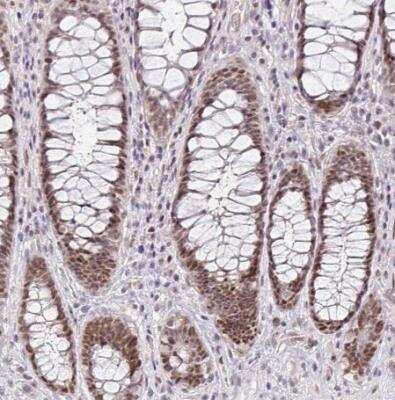 Immunohistochemistry-Paraffin: NUP188 Antibody [NBP2-38936]