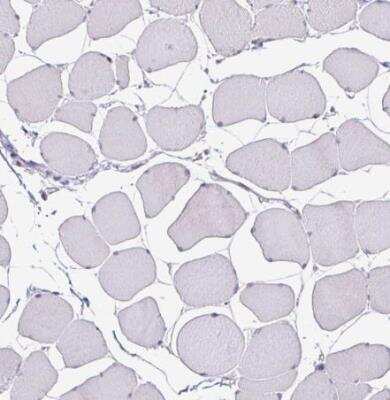 Immunohistochemistry-Paraffin: NUP188 Antibody [NBP2-38936]