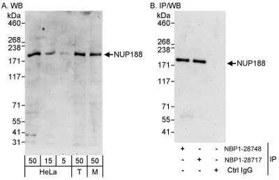 Western Blot: NUP188 Antibody [NBP1-28717]