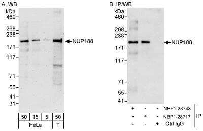 Western Blot: NUP188 Antibody [NBP1-28748]