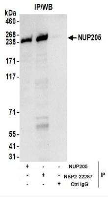 Immunoprecipitation: NUP205 Antibody [NBP2-22287]