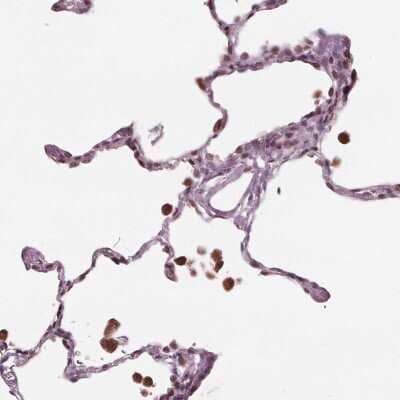 Immunohistochemistry-Paraffin: NUP210 Antibody [NBP2-39078]