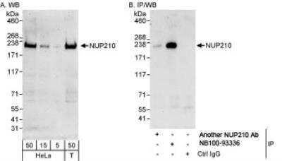 Western Blot: NUP210 Antibody [NB100-93336]