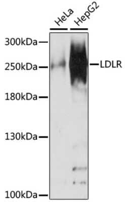 Western Blot: NUP210 AntibodyAzide and BSA Free [NBP2-93742]